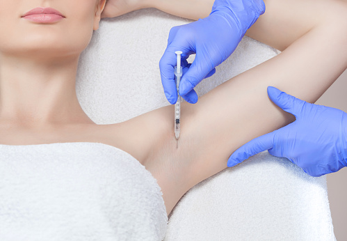 botox for sweating